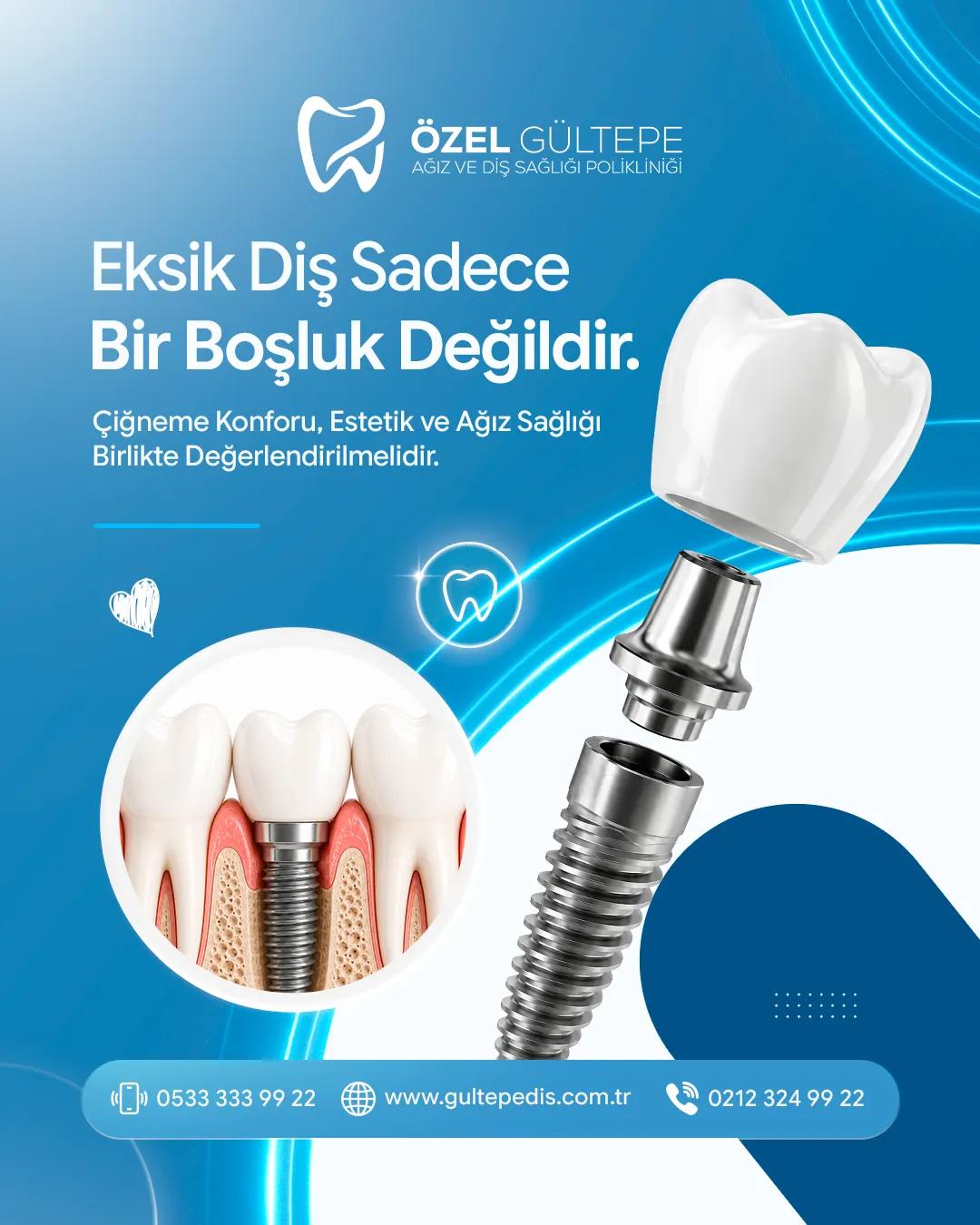 Özel Gültepe Diş sosyal medya tasarımı 8