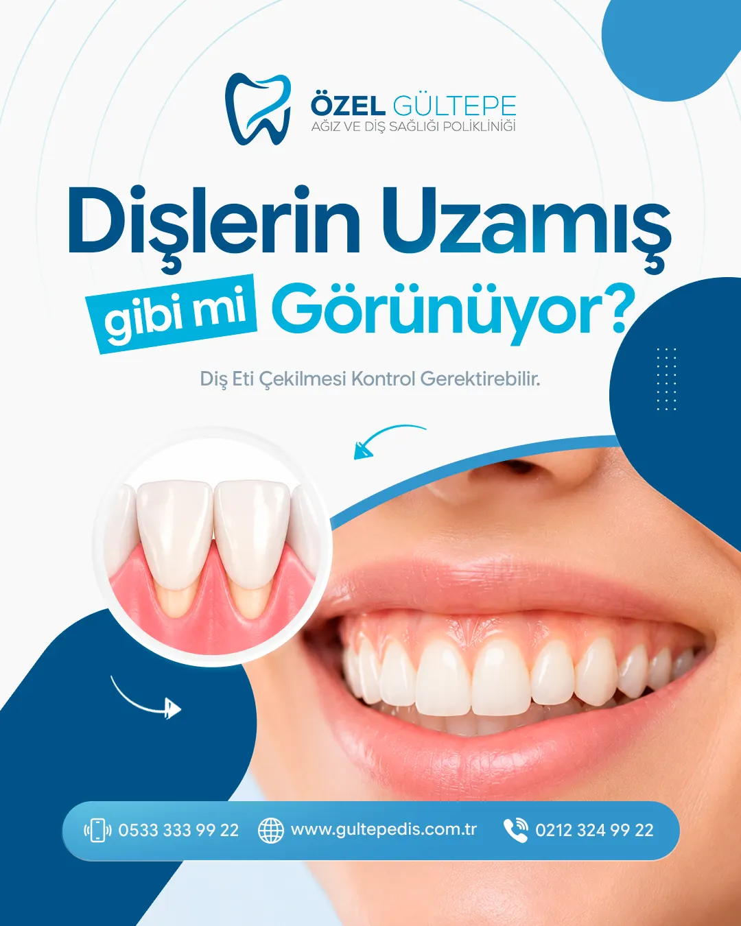 Özel Gültepe Diş sosyal medya tasarımı 19